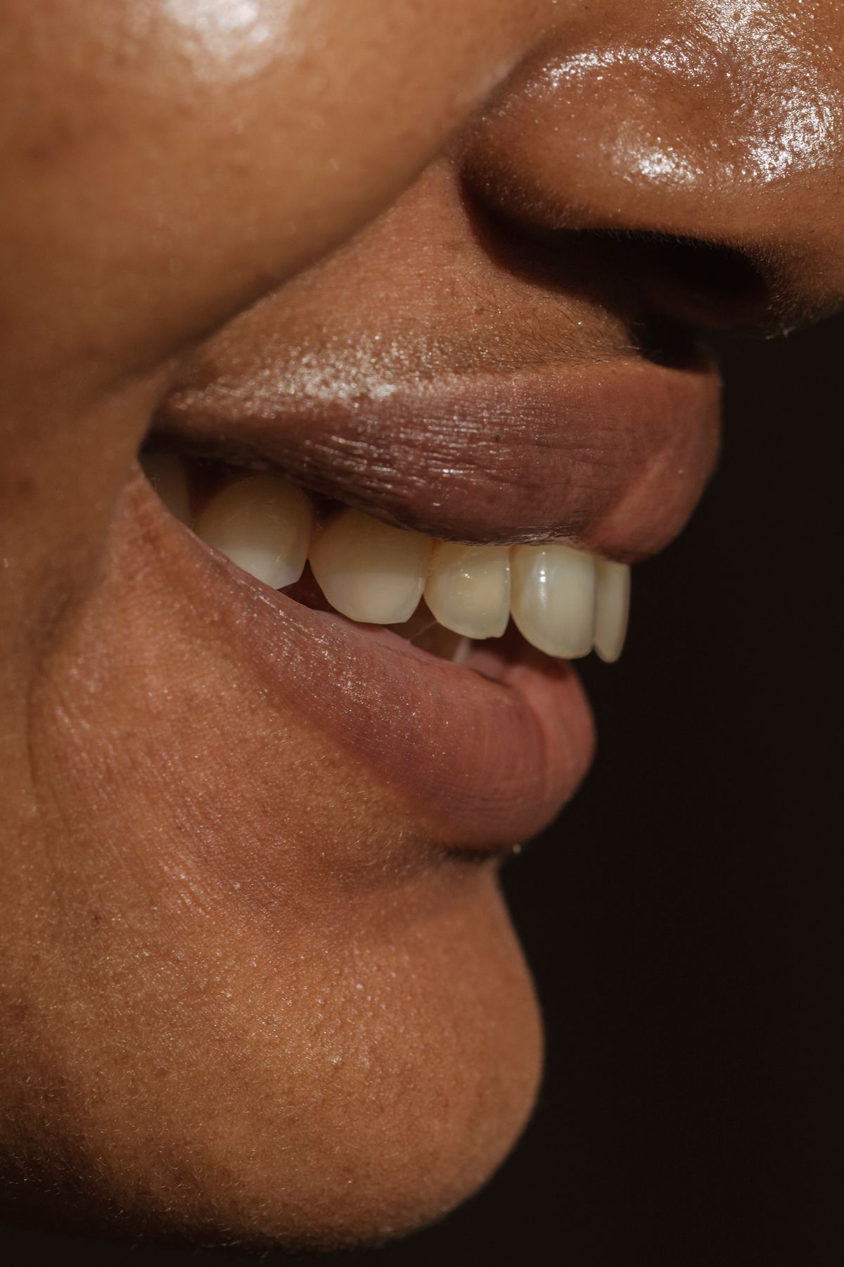 Detalhe de sorriso e lábios harmonizados